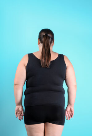 Lipedema e postura