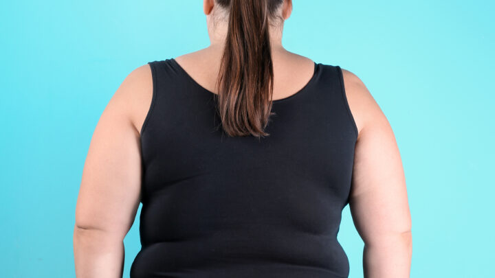 Lipedema e postura