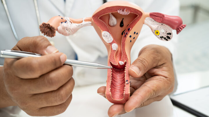 Pavimento Pelvico
